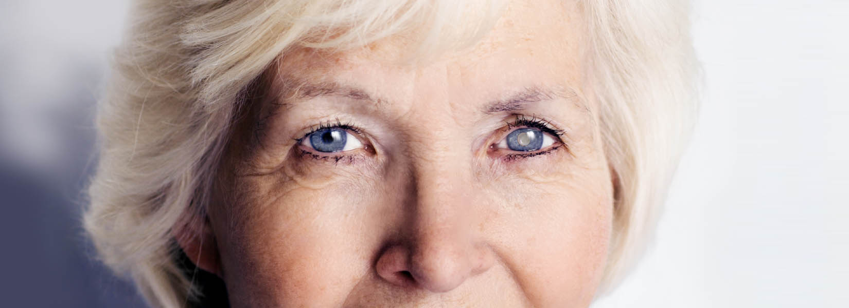 Cataract Surgery in Weatherford